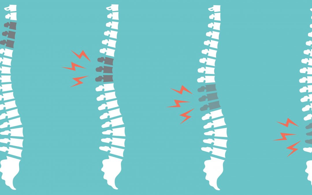 Adjacent Segment Disease